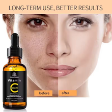 Anti-Aging Vitamin C Serum 30 ml